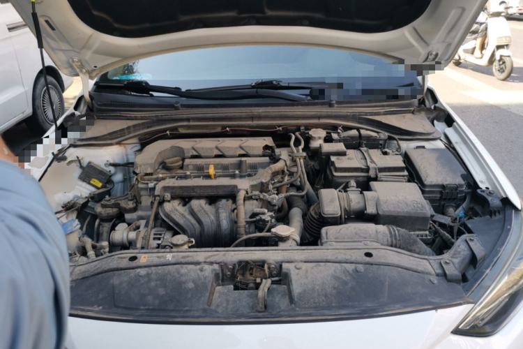 Used Hyundai Elantra (6th Generation / Lingdong) 2020 1.5L CVT Smart & Stylish – Elite Version Engine Bay
