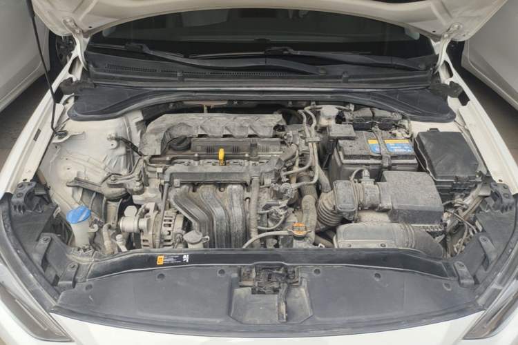 Used Hyundai Elantra (6th Generation / Lingdong) 2020 1.5L CVT Smart & Stylish – Elite Version Engine Bay