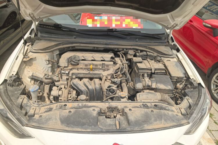 Used Hyundai Elantra (6th Generation / Lingdong) 2020 1.5L CVT Smart & Stylish – Elite Version Engine Bay