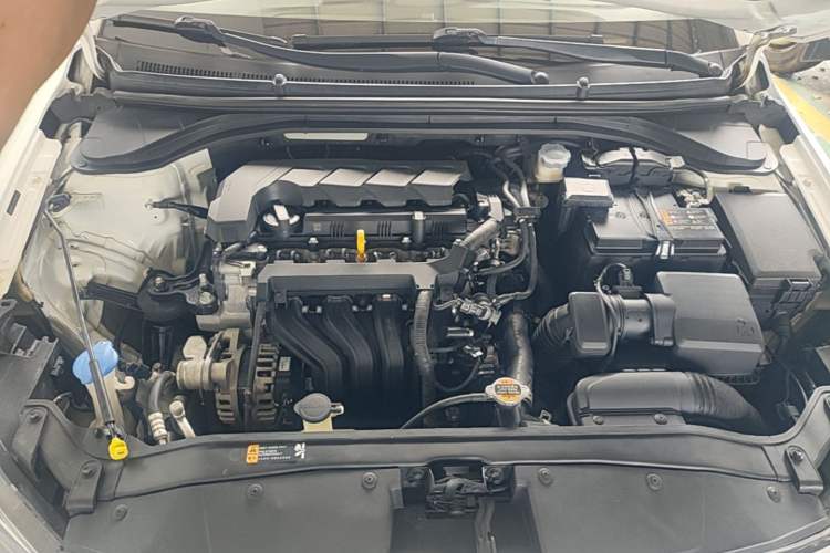 Used Hyundai Elantra (6th Generation / Lingdong) 2020 1.5L CVT Smart & Stylish – Elite Version Engine Bay