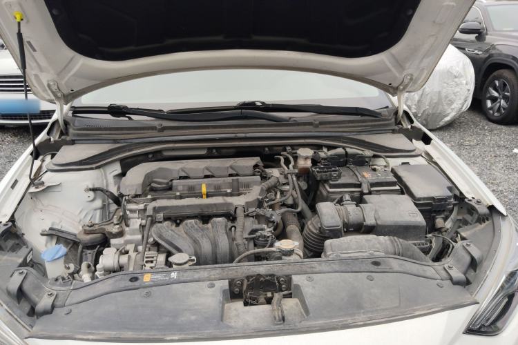 Used Hyundai Elantra (6th Generation / Lingdong) 2020 1.5L CVT Smart & Stylish – Elite Version Engine Bay