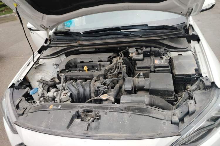 Used Hyundai Elantra (6th Generation / Lingdong) 2020 1.5L CVT Smart & Stylish – Elite Version Engine Bay