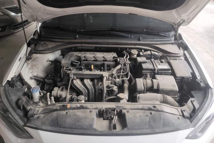 Used Hyundai Elantra (6th Generation / Lingdong) 2020 1.5L CVT Smart & Stylish – Elite Version Engine Bay