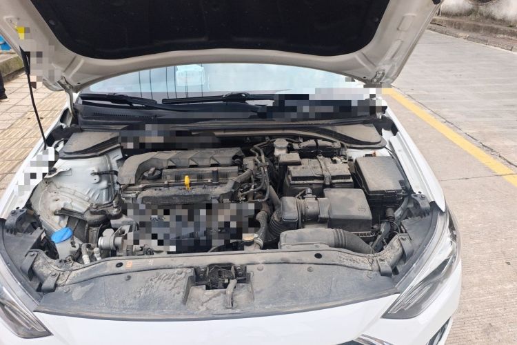 Used Hyundai Elantra (6th Generation / Lingdong) 2020 1.5L CVT Smart & Stylish – Elite Version Engine Bay Left