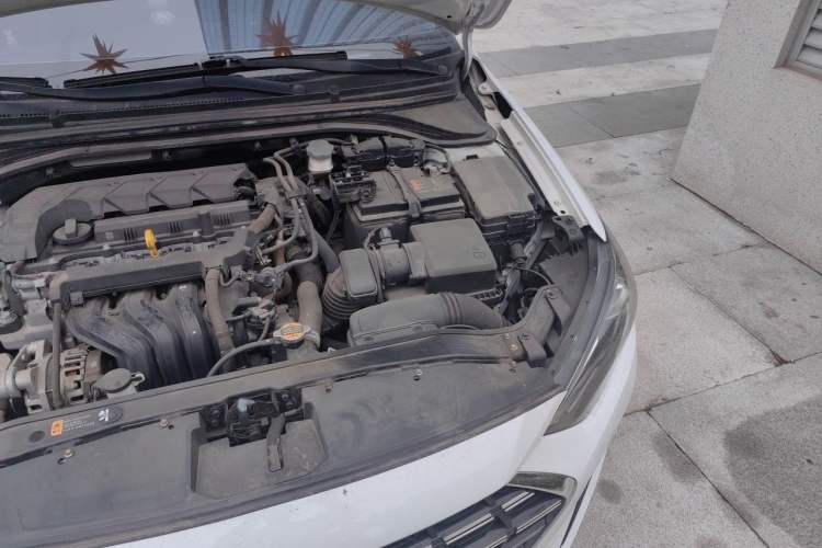 Used Hyundai Elantra (6th Generation / Lingdong) 2020 1.5L CVT Smart & Stylish – Elite Version Engine Bay Left