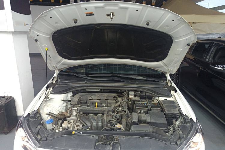 Used Hyundai Elantra (6th Generation / Lingdong) 2020 1.5L CVT Smart & Stylish – Elite Version Engine Bay