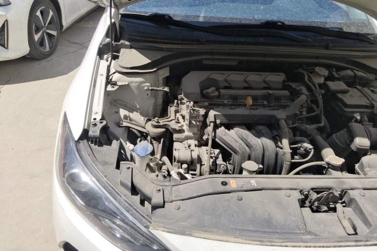 Used Hyundai Elantra (6th Generation / Lingdong) 2020 1.5L CVT Smart & Stylish – Elite Version Engine Bay Right