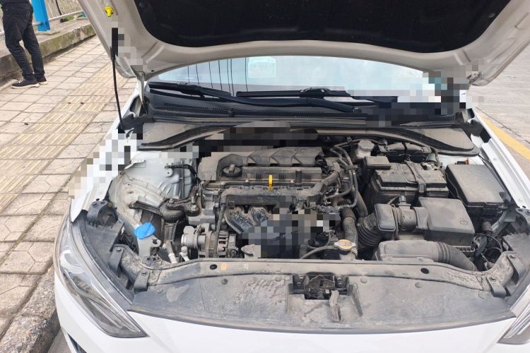 Used Hyundai Elantra (6th Generation / Lingdong) 2020 1.5L CVT Smart & Stylish – Elite Version Engine Bay Right
