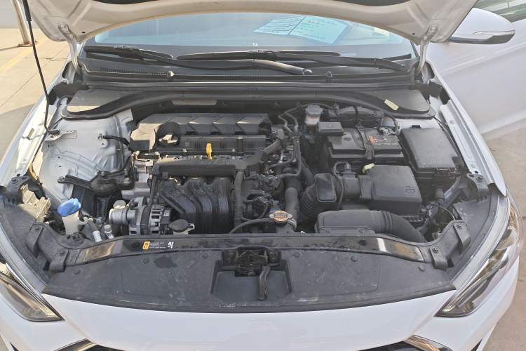 Used Hyundai Elantra (6th Generation / Lingdong) 2020 1.5L CVT Smart & Stylish – Elite Version Engine Bay