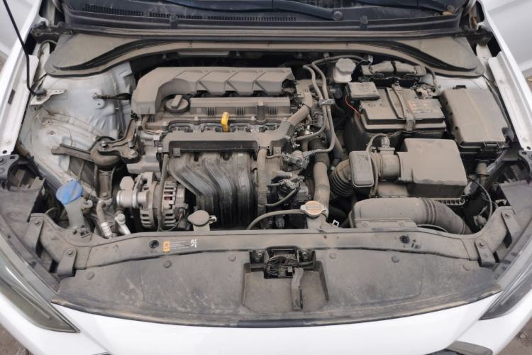 Used Hyundai Elantra (6th Generation / Lingdong) 2020 1.5L CVT Smart & Stylish – Elite Version Engine Bay