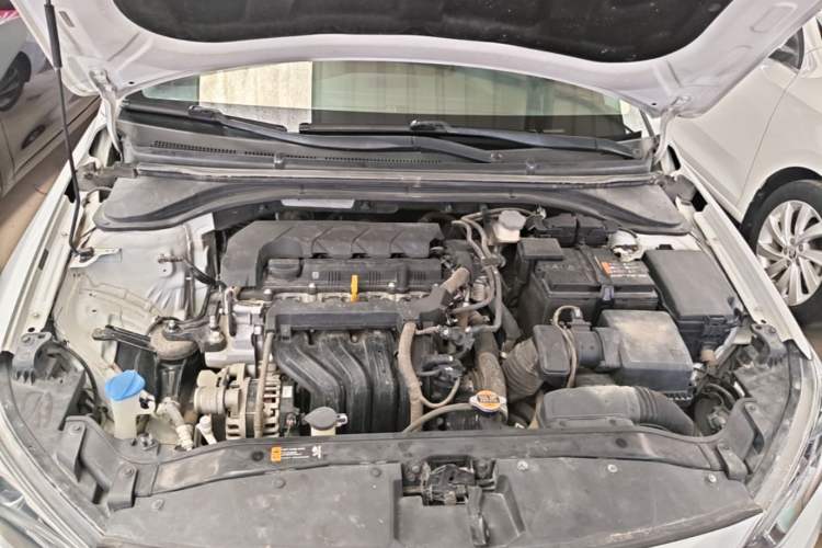 Used Hyundai Elantra (6th Generation / Lingdong) 2020 1.5L CVT Smart & Stylish – Elite Version Engine Bay