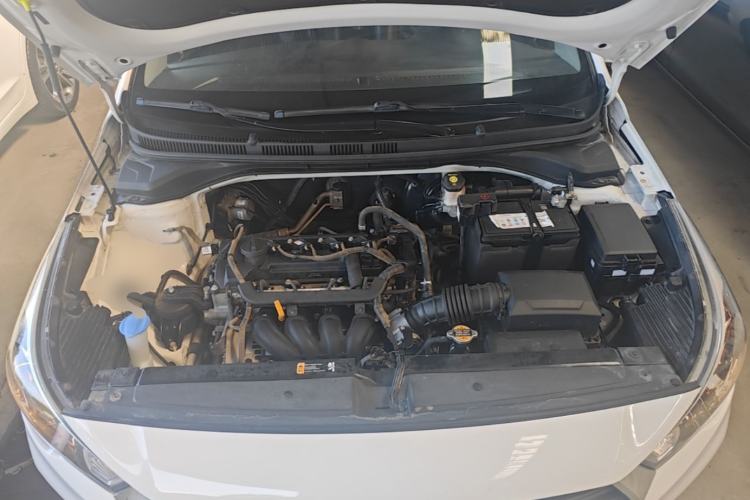 Used Hyundai Verna (new generation) 2016 1.4L Automatic Cool Edition GLS Engine Bay
