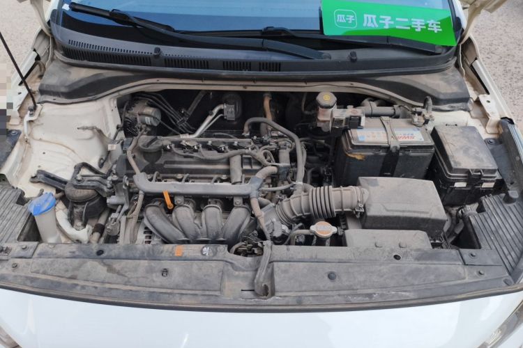 Used Hyundai Verna (new generation) 2016 1.4L Automatic Cool Edition GLS Engine Bay