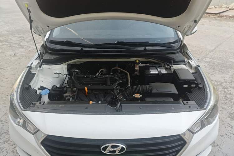 Used Hyundai Verna (new generation) 2016 1.4L Automatic Cool Edition GLS Engine Bay