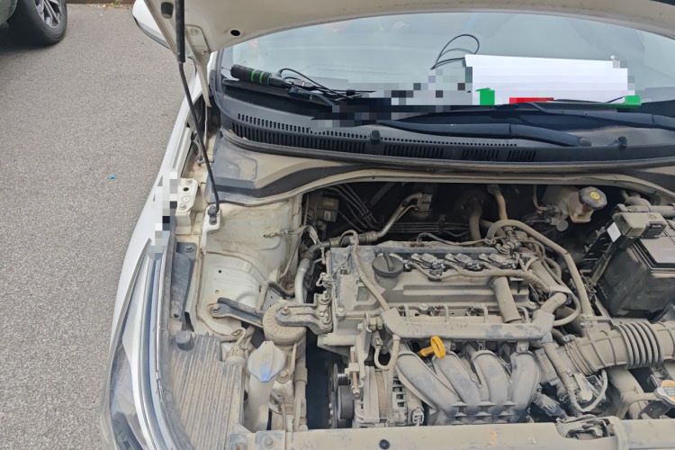 Used Hyundai Verna (new generation) 2016 1.4L Automatic Cool Edition GLS Engine Bay Right