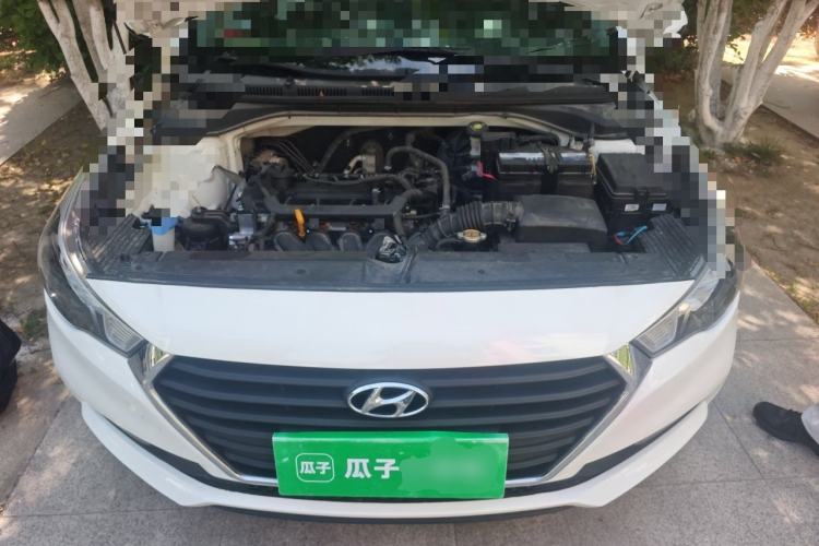 Used Hyundai Verna (new generation) 2016 1.4L Manual Cool Edition GLS Engine Bay