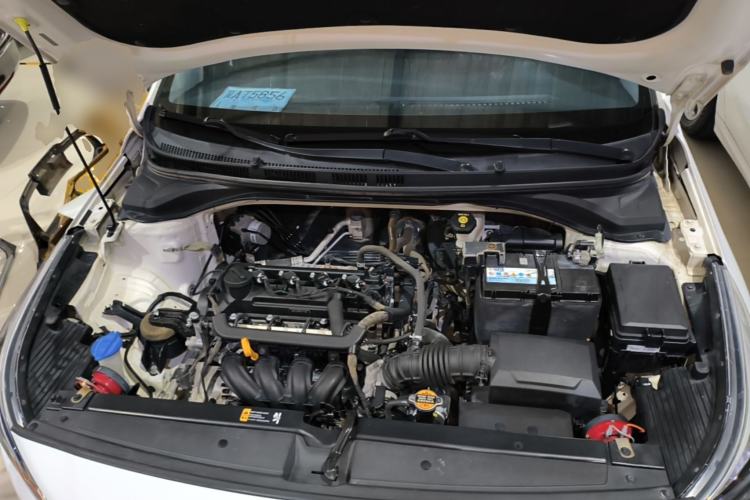 Used Hyundai Verna (new generation) 2016 1.4L Automatic Cool Edition GLS Engine Bay