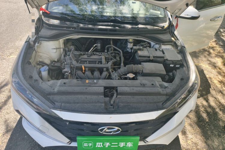Used Hyundai Verna (new generation) 2020 1.4L Manual GLS Cool Edition Engine Bay