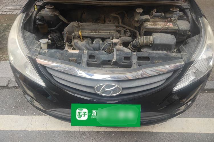 Used Hyundai Verna (older generation) 2010 Sedan 1.4L Manual Comfort GS Engine Bay