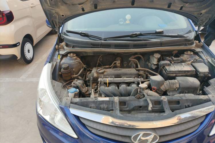 Used Hyundai Verna (older generation) 2010 Sedan 1.4L Automatic Fashionable GT Model Engine Bay Right