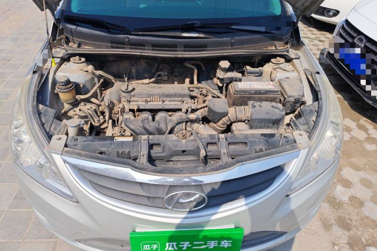 Used Hyundai Verna (older generation) 2010 Sedan 1.4L Manual Comfort GS Engine Bay