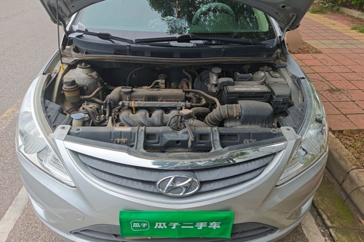 Used Hyundai Verna (older generation) 2010 Sedan 1.4L Manual Comfort GS Engine Bay