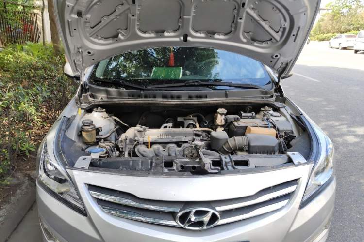 Used Hyundai Verna (older generation) 2014 1.4L Manual Smart GLS Trim Engine Bay