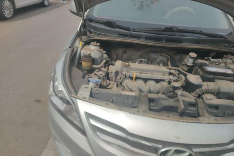 Used Hyundai Verna (older generation) 2014 1.4L Manual Smart GLS Trim Engine Bay Right