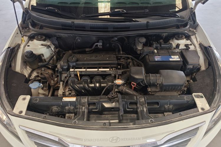 Used Hyundai Verna (older generation) 2014 1.4L Automatic Smart GLS Engine Bay