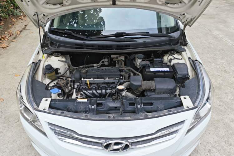 Used Hyundai Verna (older generation) 2014 1.4L Manual Smart GLS Trim Engine Bay