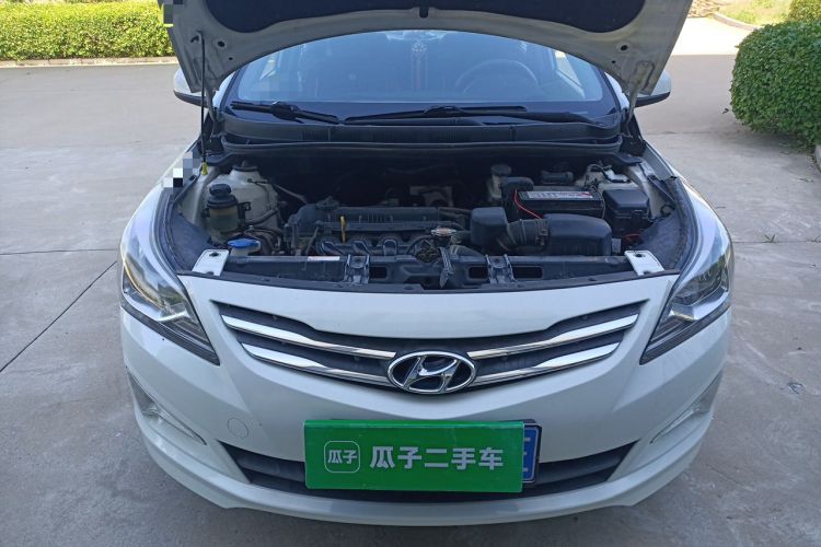 Used Hyundai Verna (older generation) 2014 1.4L Manual Smart GLS Trim Engine Bay