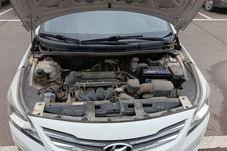Used Hyundai Verna (older generation) 2014 1.4L Manual Smart GLS Trim Engine Bay