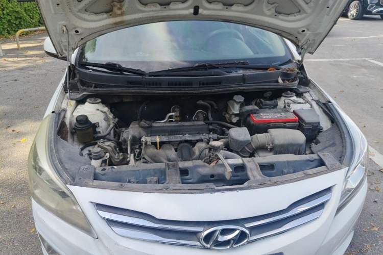 Used Hyundai Verna (older generation) 2014 1.4L Manual Smart GLS Trim Engine Bay