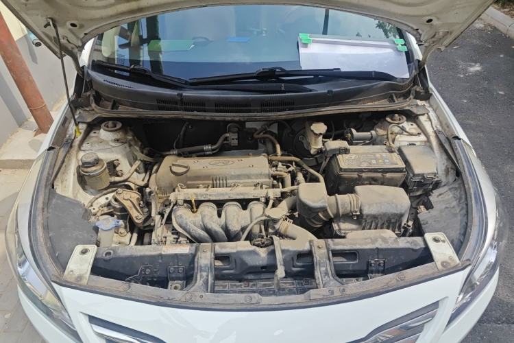 Used Hyundai Verna (older generation) 2014 1.4L Manual Smart GLS Trim Engine Bay