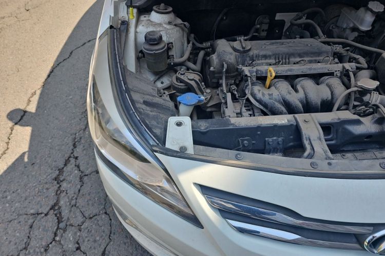 Used Hyundai Verna (older generation) 2014 1.4L Manual Smart GLS Trim Engine Bay Right
