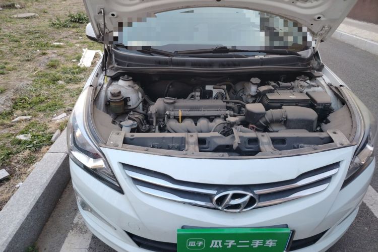 Used Hyundai Verna (older generation) 2014 1.4L Automatic Smart GLS Engine Bay Right