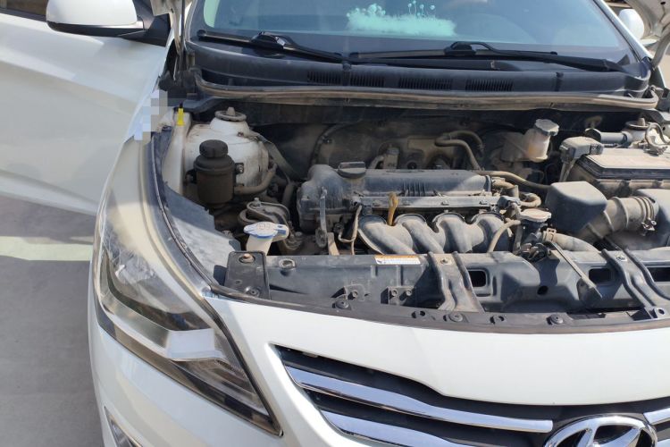 Used Hyundai Verna (older generation) 2014 1.4L Manual Smart GLS Trim Engine Bay Right