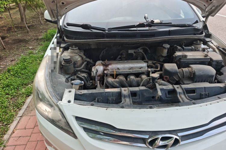 Used Hyundai Verna (older generation) 2014 1.4L Automatic Smart GLS Engine Bay Right