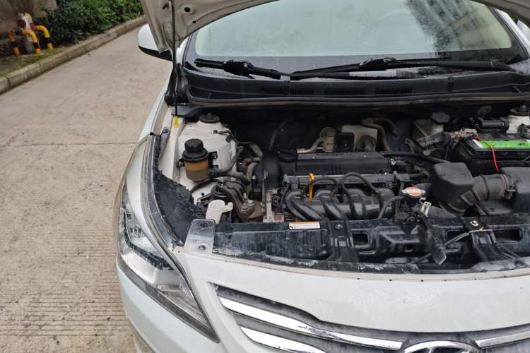 Used Hyundai Verna (older generation) 2014 1.4L Manual Smart GLS Trim Engine Bay Right