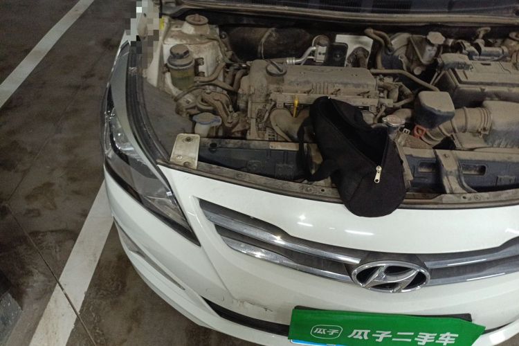 Used Hyundai Verna (older generation) 2014 1.4L Automatic Smart GLS Engine Bay Right