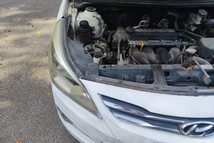 Used Hyundai Verna (older generation) 2014 1.4L Manual Smart GLS Trim Engine Bay Right
