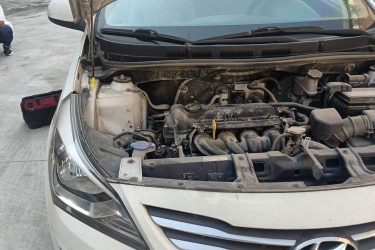 Used Hyundai Verna (older generation) 2014 1.4L Manual Smart GLS Trim Engine Bay Right