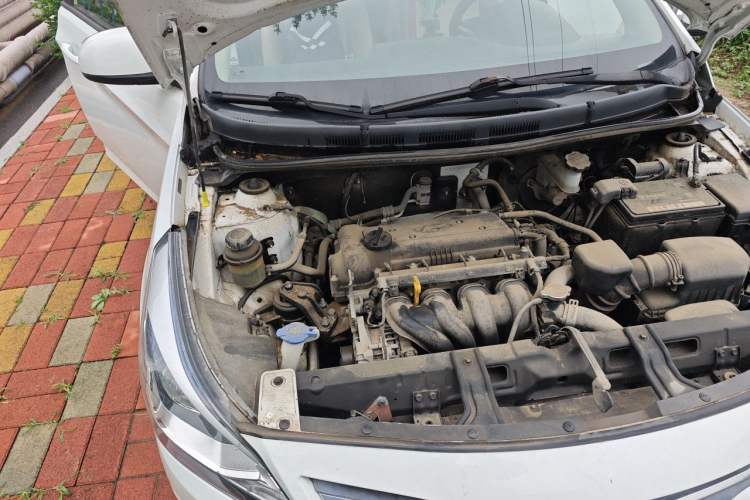 Used Hyundai Verna (older generation) 2014 1.4L Manual Smart GLS Trim Engine Bay Right