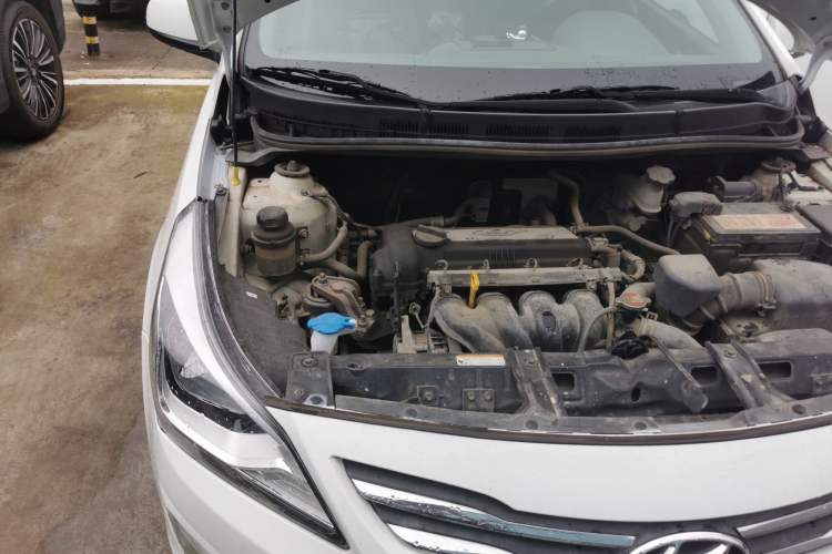 Used Hyundai Verna (older generation) 2014 1.4L Manual Smart GLS Trim Engine Bay Right