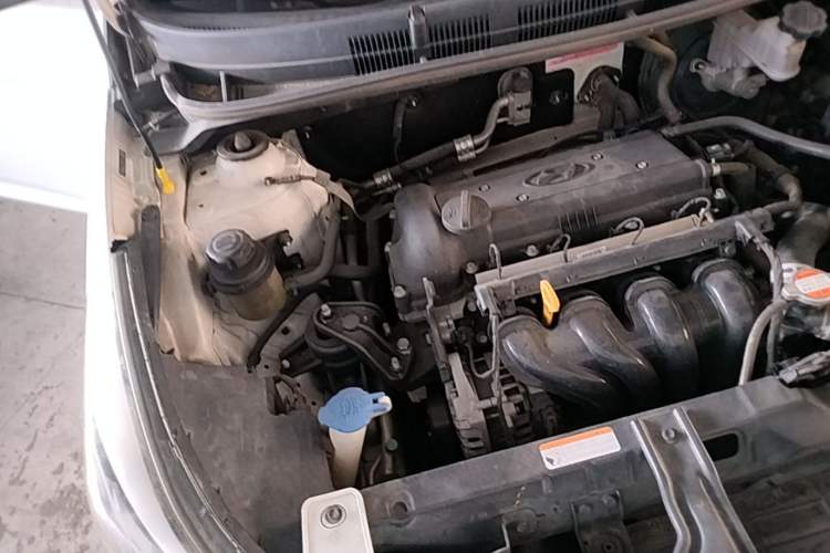 Used Hyundai Verna (older generation) 2014 1.4L Manual Smart GLS Trim Engine Bay Right