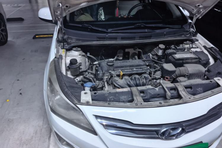 Used Hyundai Verna (older generation) 2014 1.4L Automatic Smart GLS Engine Bay Right