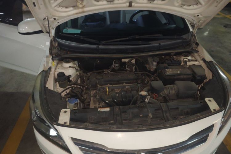 Used Hyundai Verna (older generation) 2014 1.4L Automatic Smart GLS Engine Bay Right