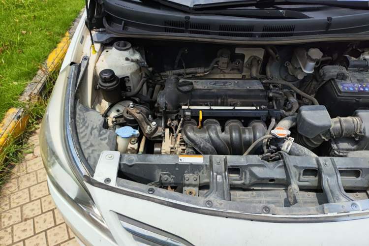 Used Hyundai Verna (older generation) 2014 1.4L Manual Smart GLS Trim Engine Bay Right