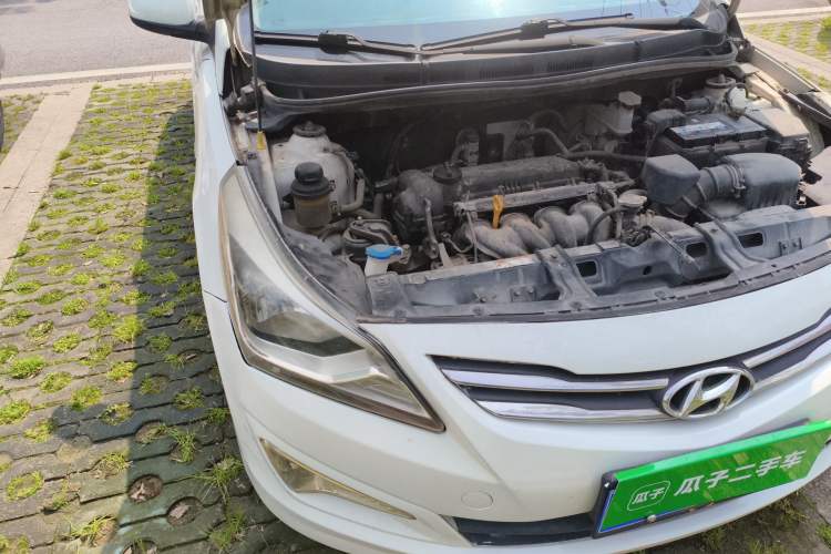 Used Hyundai Verna (older generation) 2014 1.4L Manual Smart GLS Trim Engine Bay Right