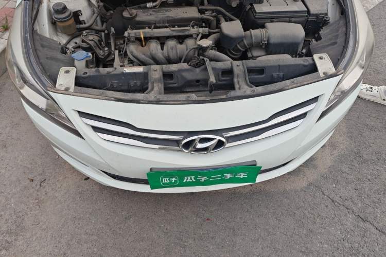 Used Hyundai Verna (older generation) 2014 1.4L Manual Smart GLS Trim Engine Bay
